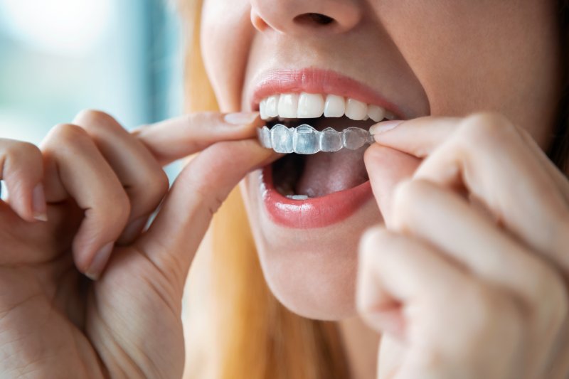 Young woman holding her invisalign